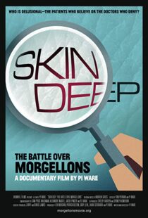 دانلود مستند Skin Deep: The Battle Over Morgellons 2019104233-527174523